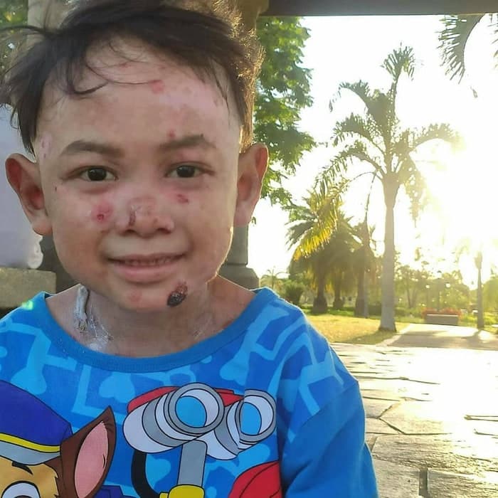 Help save Liam