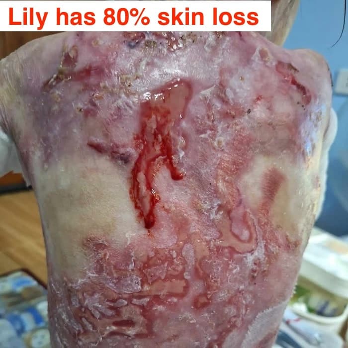 Help save Lily