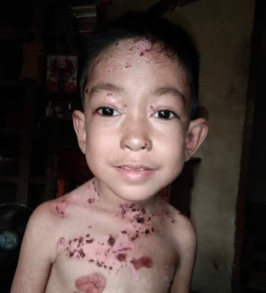 Help save Mark