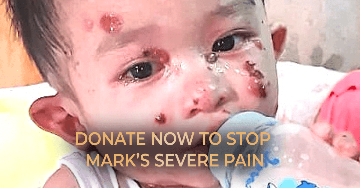 Help save Mark