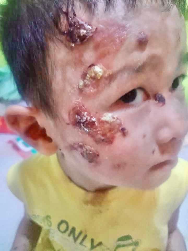 Help save Mark
