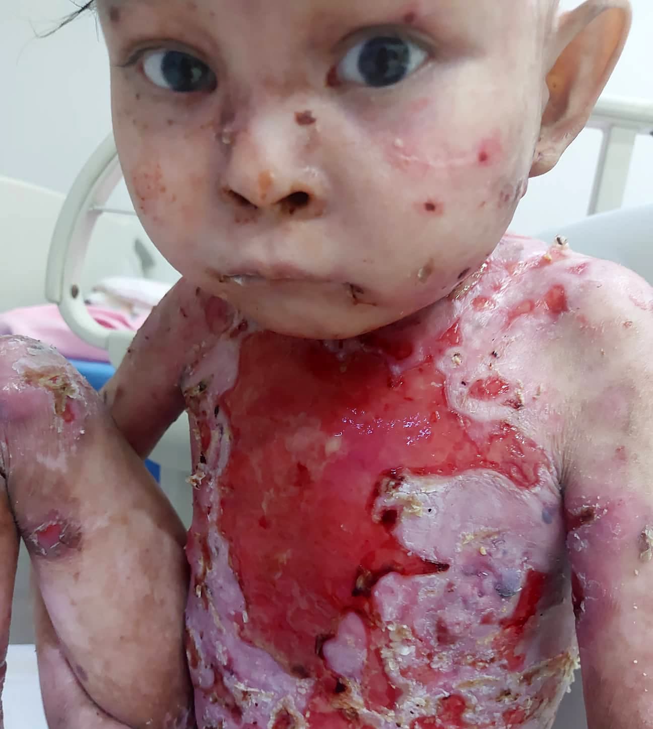 Help save Mirachael