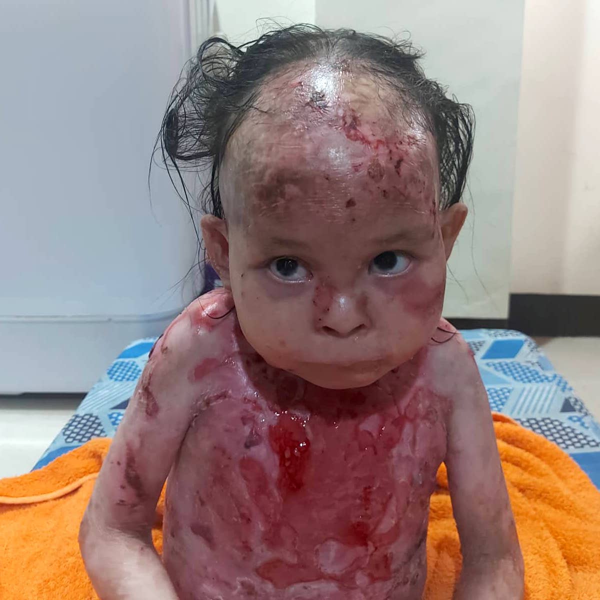 Help save Mirachael