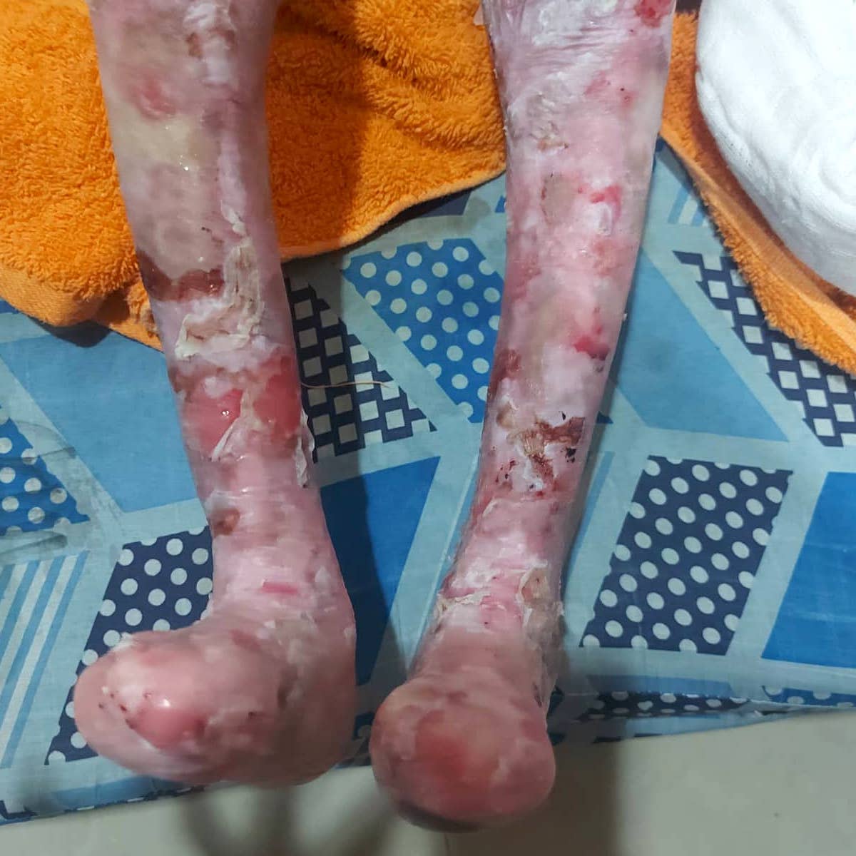 Help save Mirachael