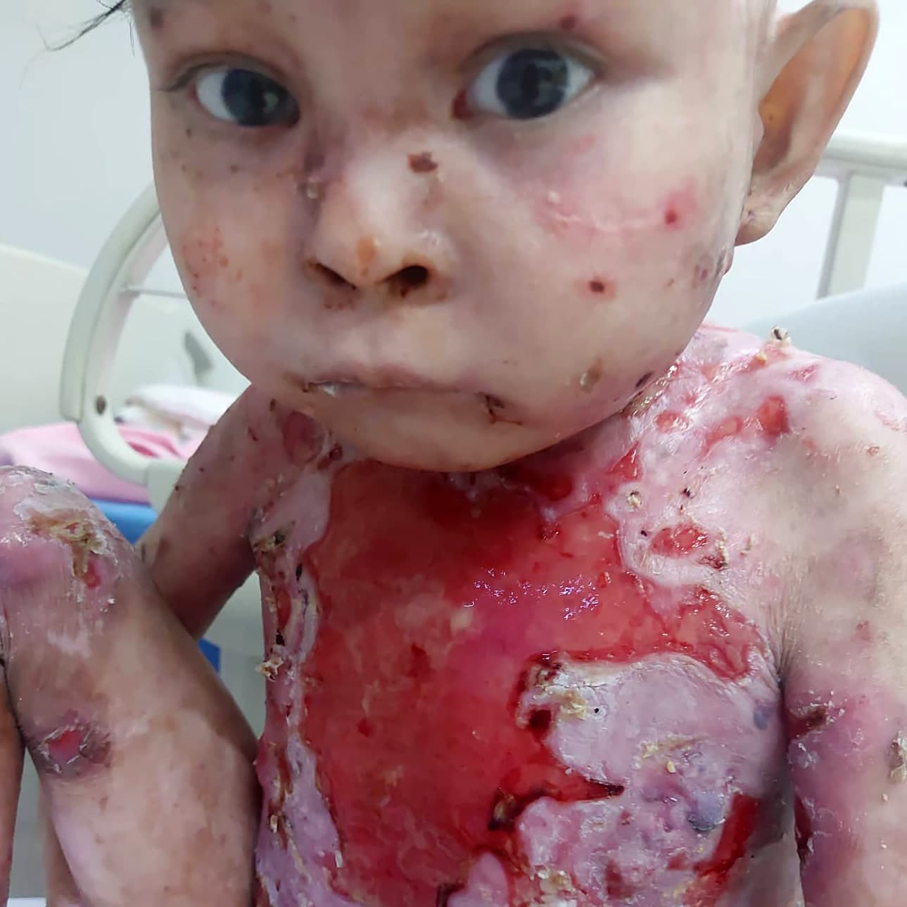 Help save Mirachael